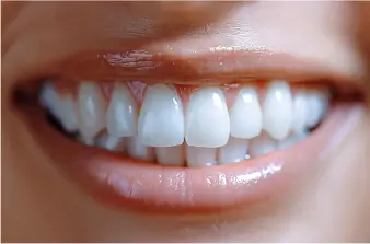 After Treatment