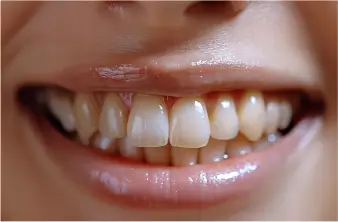 Before Treatment